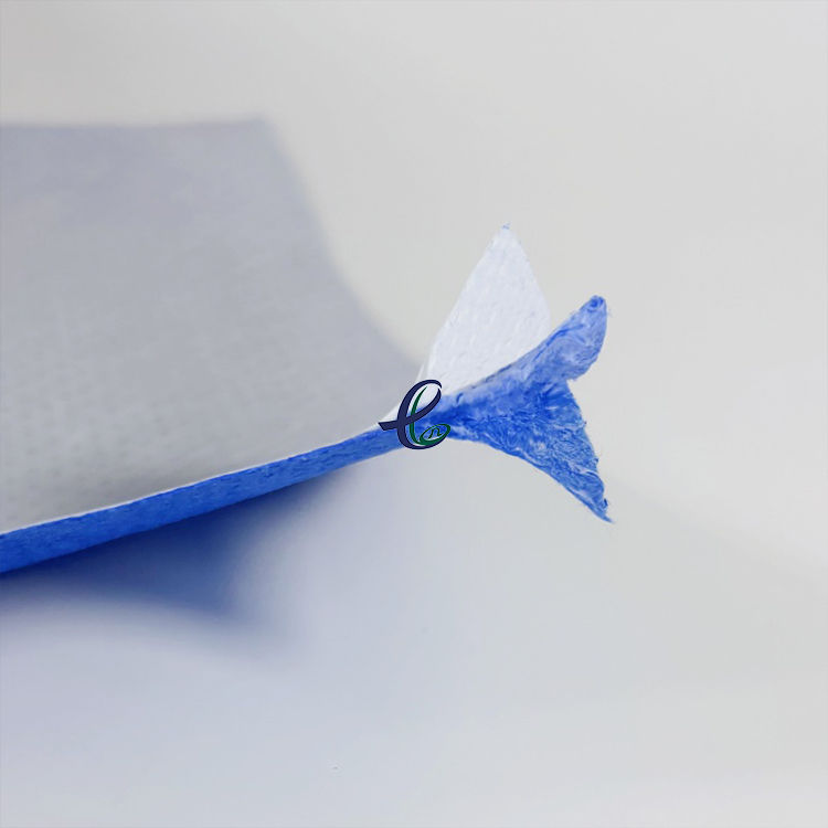 hydrophilic nonwoven,sms nonwoven fabric.jpg